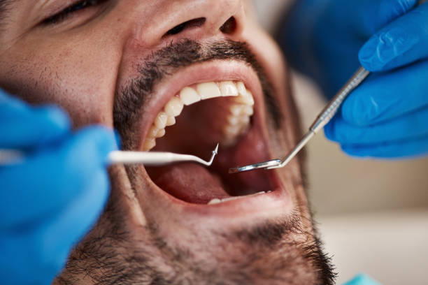 Best Tooth Extraction  in Greenvle, IL